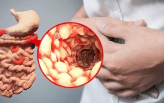 GW health blog image